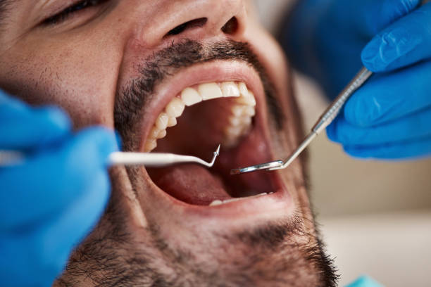 Best Pediatric Emergency Dentist in Bluffton, OH